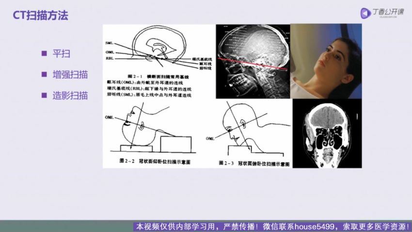 丁香园：手把手教你读懂头颅 CT【共10节】【全】【298元】