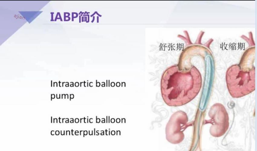 丁香园：急性心衰的规范及治疗